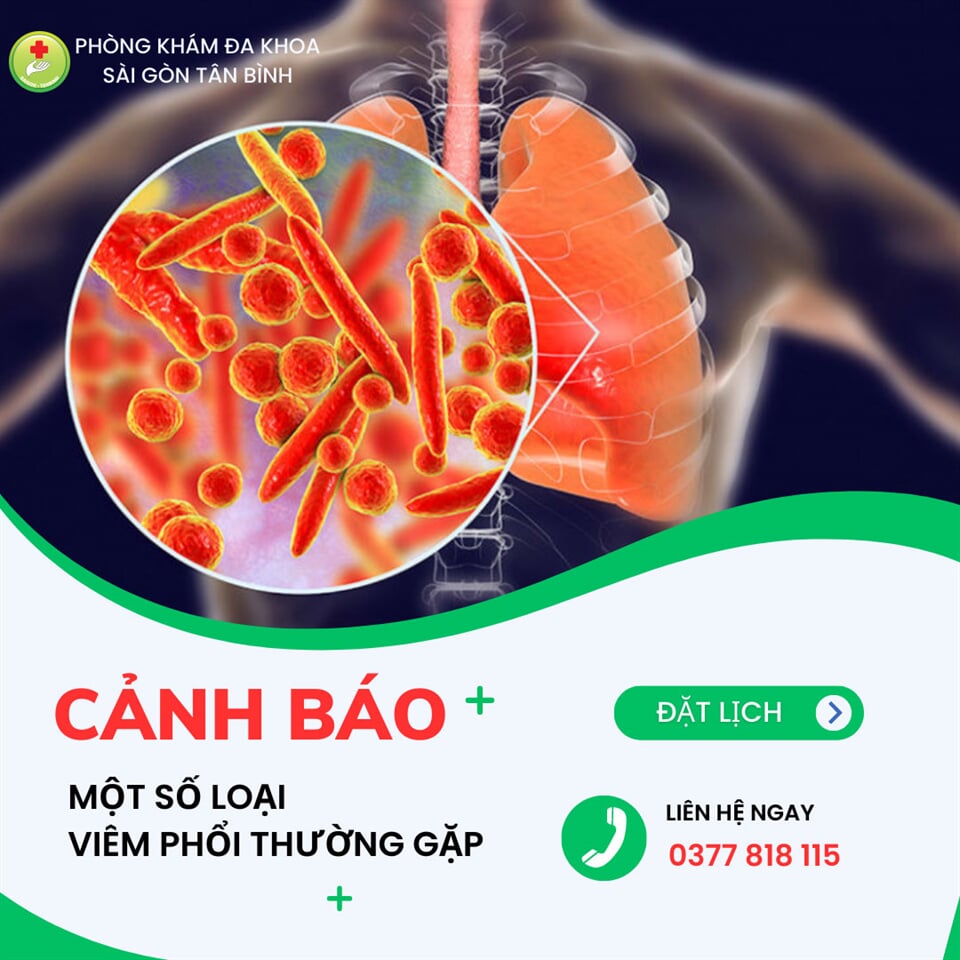 benh-viem-phoi-co-rat-nhieu-nguyen-nhan-gay-ra